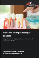 Monconi in implantologia dentale (Italian Edition) 6208631963 Book Cover