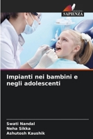 Impianti nei bambini e negli adolescenti (Italian Edition) 6208250684 Book Cover