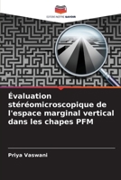 Évaluation stéréomicroscopique de l'espace marginal vertical dans les chapes PFM 6207377478 Book Cover
