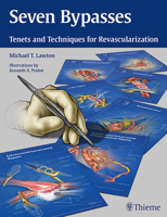 Seven Bypasses: Tenets and Techniques for Revascularization 1626234833 Book Cover