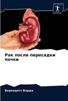 Рак после пересадки почк 6203518360 Book Cover