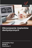 Obrazowanie implantów dentystycznych (Polish Edition) 6208558697 Book Cover