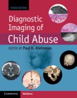 Diagnostic Imaging of Child Abuse 1107010535 Book Cover