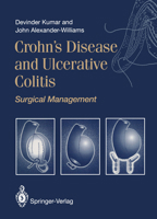 Crohn's Disease and Ulcerative Colitis: Surgical Management 3540197303 Book Cover