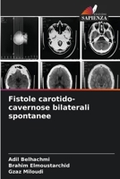 Fistole carotido-cavernose bilaterali spontanee (Italian Edition) 663032899X Book Cover