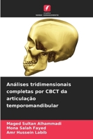 Análises tridimensionais completas por CBCT da articulação temporomandibular (Portuguese Edition) 6209805094 Book Cover