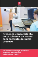 Presença concomitante de carcinoma da mama com catarata de início precoce (Portuguese Edition) 6208015278 Book Cover