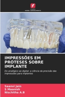 Impressões Em Próteses Sobre Implante (Portuguese Edition) 6630278216 Book Cover