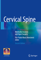 Cervical Spine: Minimally Invasive and Open Surgery 3319361023 Book Cover