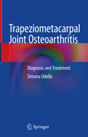 Trapeziometacarpal Joint Osteoarthritis: Diagnosis and Treatment 3319443348 Book Cover