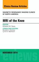 MRI of the Knee, an Issue of Magnetic Resonance Imaging Clinics of North America 0323323790 Book Cover