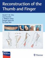 An Atlas of Digit Reconstruction: The Ray and Cascade Principle 1626235740 Book Cover
