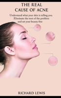 The Real Cause Of Acne: Understand what your skin is telling you. Eliminate the root of the problem and set your beauty free! B08FNJK5NW Book Cover