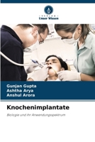 Knochenimplantate: Biologie und ihr Anwendungsspektrum (German Edition) 6208799732 Book Cover