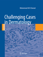 Challenging Cases in Dermatology 1447171993 Book Cover