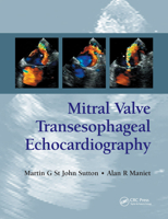 Mitral Valve Transesophageal Echocardiography B000NKMREO Book Cover