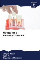 Неудачи в имплантологии 620630714X Book Cover
