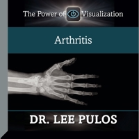 Arthritis B08ZBM2RL2 Book Cover