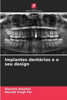 Implantes dentários e o seu design (Portuguese Edition) 6630106539 Book Cover