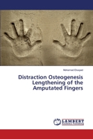 Distraction Osteogenesis Lengthening of the Amputated Fingers 3330331585 Book Cover