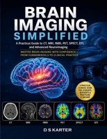 BRAIN IMAGING SIMPLIFIED Vol - ONE: A Practical Guide to Brain CT, MRI, Emergency Neuroimaging, Stroke Imaging, Tumor Imaging, and Advanced Neuroimaging (The Doctor's Clinical Library) B0HBCBB2S4 Book Cover