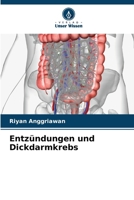 Entzündungen und Dickdarmkrebs 6206620387 Book Cover