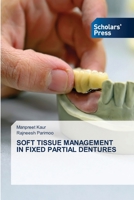 Soft Tissue Management in Fixed Partial Dentures 6138951719 Book Cover