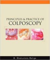 Principles and Practice of Colposcopy 0071446591 Book Cover