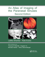 An Atlas of Imaging of the Paranasal Sinuses 0367390728 Book Cover