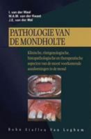 Pathologie van de mondholte: Klin,rontgenol,histopathol+therap.apect. aandoeningen mond 9031338745 Book Cover