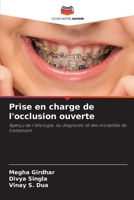 Prise en charge de l'occlusion ouverte (French Edition) 6209959806 Book Cover