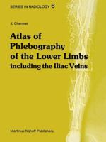 Atlas of Phlebography of the Lower Limbs: Including the Iliac Veins 9400974639 Book Cover