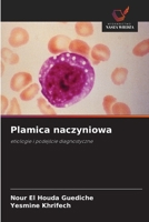 Plamica naczyniowa (Polish Edition) 6209406335 Book Cover