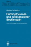 Huftkopfnekrose Und Gefassgestielter Beckenspan: Studie Zu Angiographie Und Vaskularisation 3540538062 Book Cover
