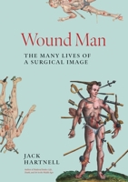 Wound Man: The Many Lives of a Surgical Image 0691243484 Book Cover