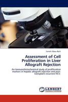 Assessment of Cell Proliferation in Liver Allograft Rejection: An Immunohistochemical study of proliferation markers in hepatic allograft rejection and post-transplant recurrent HCV. 3846530670 Book Cover