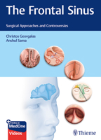 The Frontal Sinus: Surgical Approaches and Controversies 3132400521 Book Cover