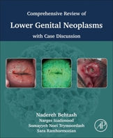 Comprehensive review of lower genital neoplasms: With case discussion 0443445648 Book Cover