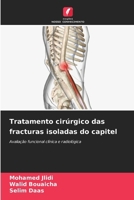 Tratamento cirúrgico das fracturas isoladas do capitel (Portuguese Edition) 6207897625 Book Cover