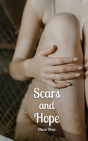Scars and Hope 9916896348 Book Cover