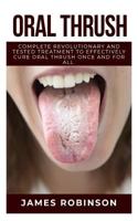 Oral Thrush: Complete Revolutionary and Tested Treatment to Effectively Cure Oral Thrush Once and For All 1729039995 Book Cover