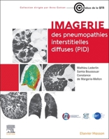 Imagerie des pneumopathies interstitielles diffuses (PID) 2294781902 Book Cover