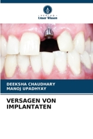 Versagen Von Implantaten 6206083918 Book Cover
