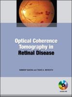 Optical Coherence Tomography 0071601872 Book Cover