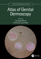 Atlas of Genital Dermoscopy 036744027X Book Cover