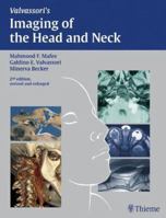 Imaging of the Head and Neck 1588900096 Book Cover