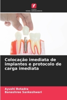 Colocação imediata de implantes e protocolo de carga imediata (Portuguese Edition) 6208533317 Book Cover