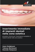Colocação imediata de implantes dentários na zona estética: procedimentos clínicos para a colocação imediata de implantes dentários na zona estética (Portuguese Edition) 620643513X Book Cover