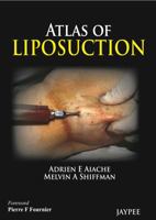 Atlas of Liposuction 9350903458 Book Cover