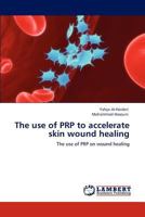 The use of PRP to accelerate skin wound healing: The use of PRP on wound healing 3846522139 Book Cover